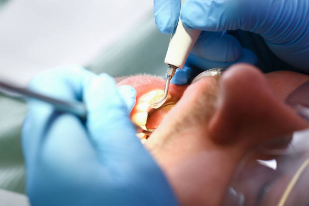 Best Urgent Care for Lost Fillings or Crowns in St Paul, TX