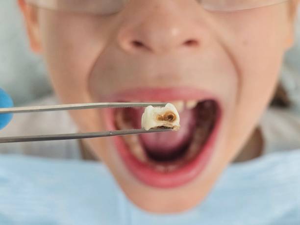 Best Emergency Orthodontic Services in St Paul, TX